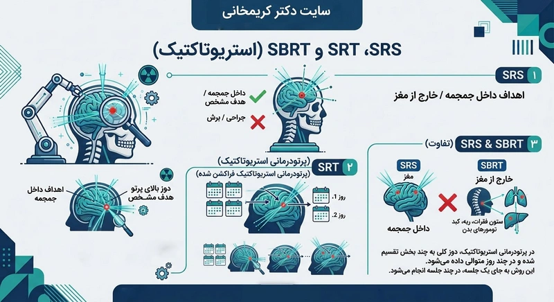 فرق srs با srt با sbrt -dr-karimkhani